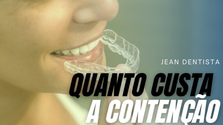 Pre&ccedil;o do Aparelho de Conten&ccedil;&atilde;o: Guia de Compras