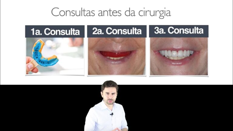 Transforma&ccedil;&atilde;o com Implante Dent&aacute;rio: Antes e Depois