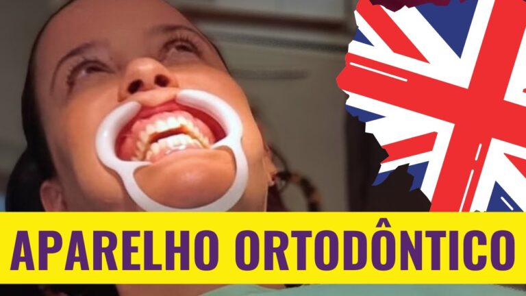 Preço de aparelho para os dentes: guia completo