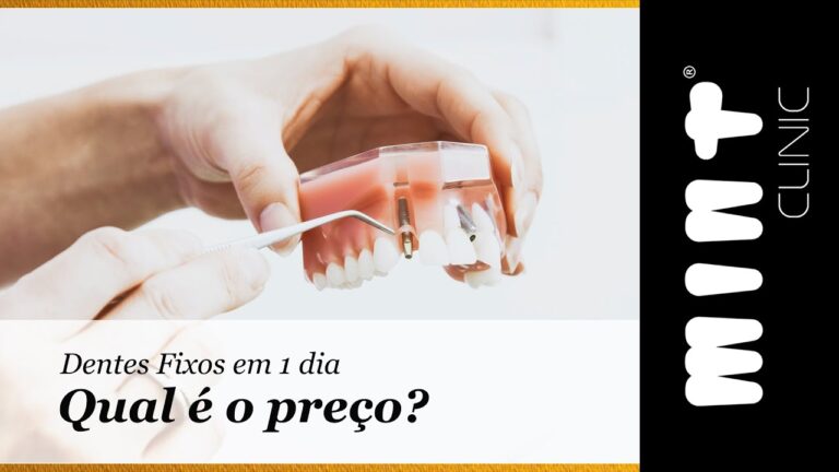 Preços de Implantes Dentários: Guia Completo de Custos